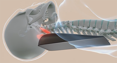 spine aligner neck position xray below view